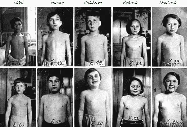 Children Treated with Hemp for Tuberculosis